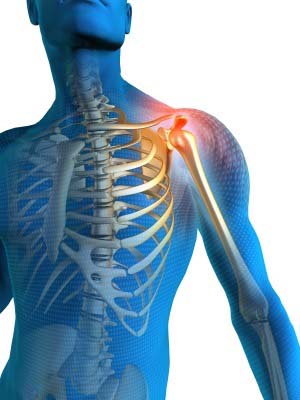 Shoulder pain